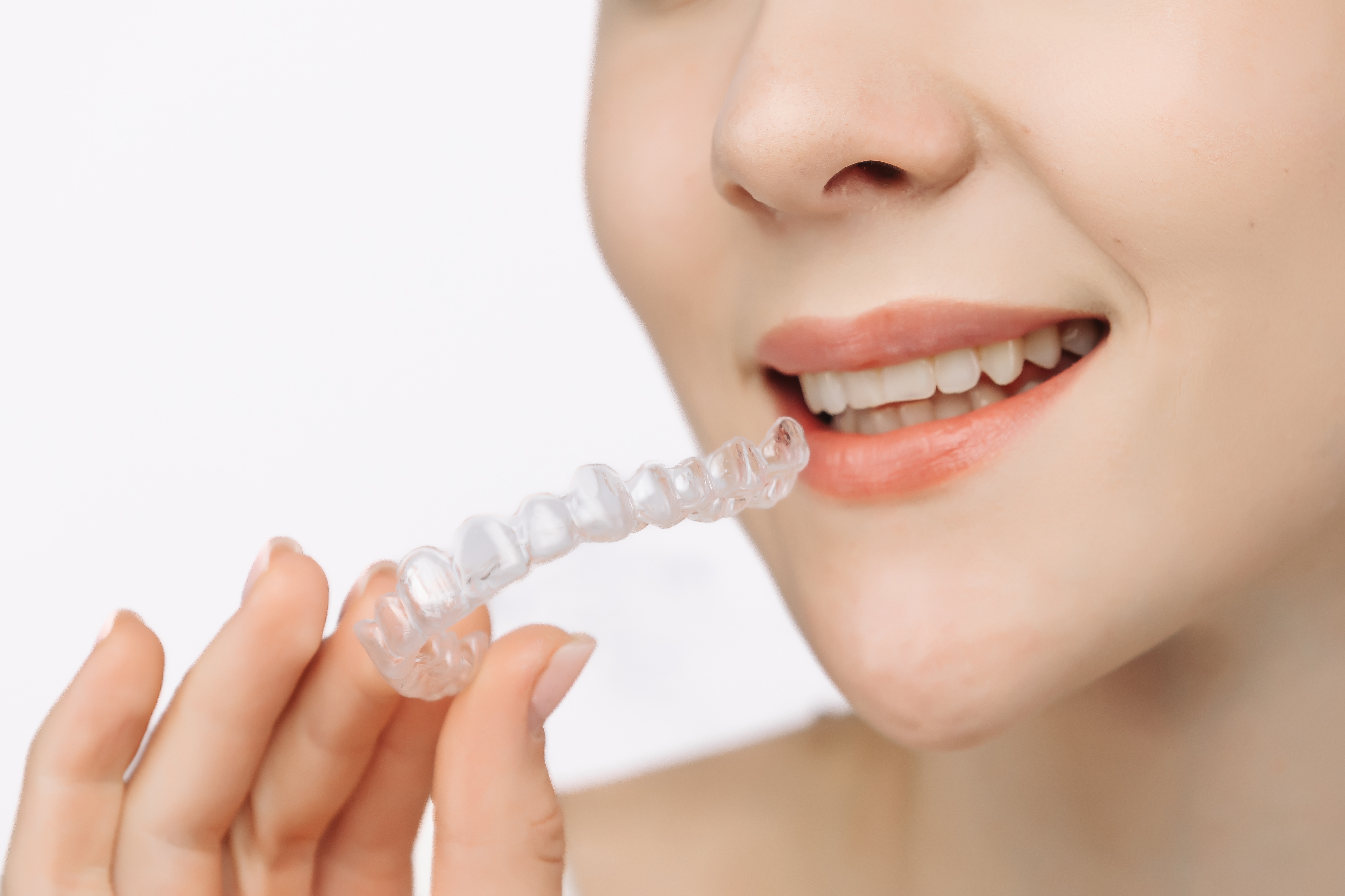 Do Clear Aligners Hurt?